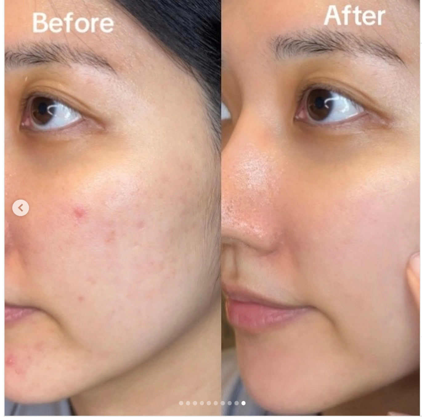 Capsule Serum Vit C ( Trending)